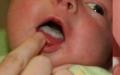 Effective ways to treat stomatitis in children: what to do if a child has a sore mouth?